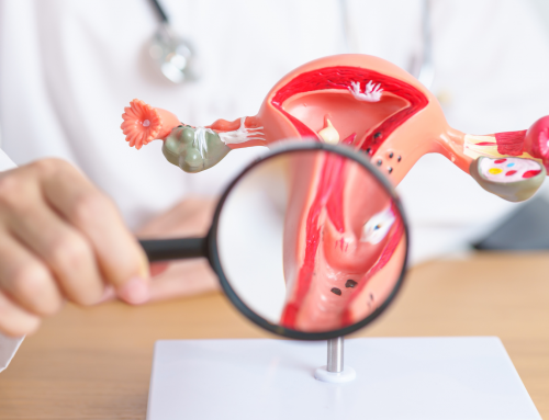 Uterine Fibroids: Symptoms, Causes & Treatment Options in Reno